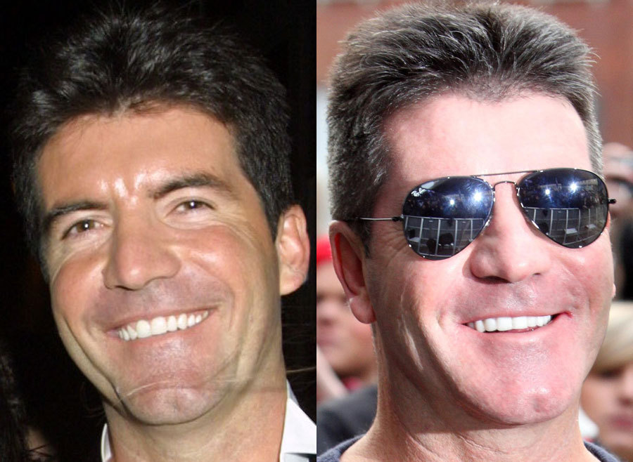 14.-Simon-Cowellv