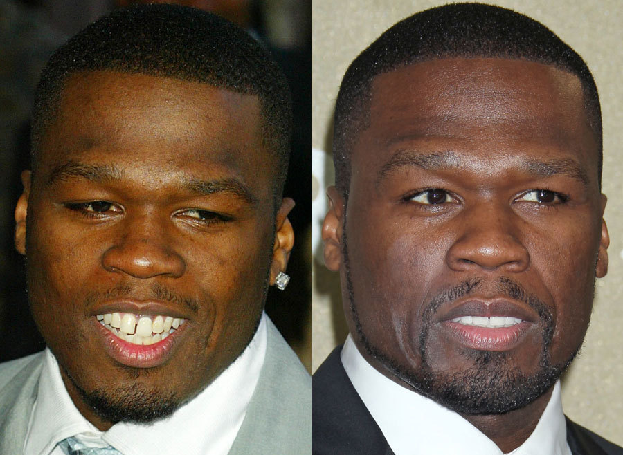 17.-50-Cent