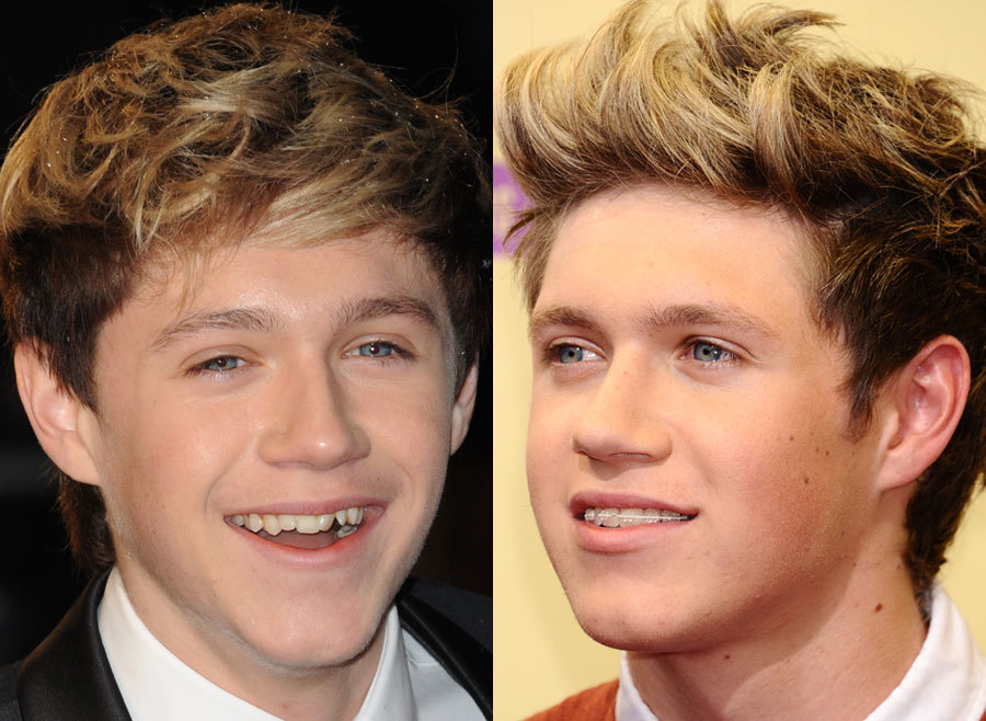 20.-Nial-Horan