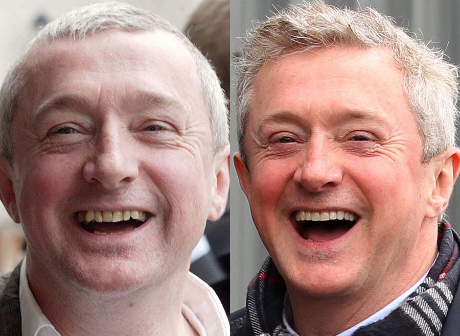 21.-Louis-Walsh