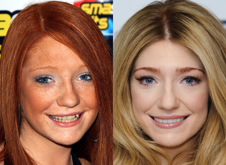 6.-Nicola-Roberts