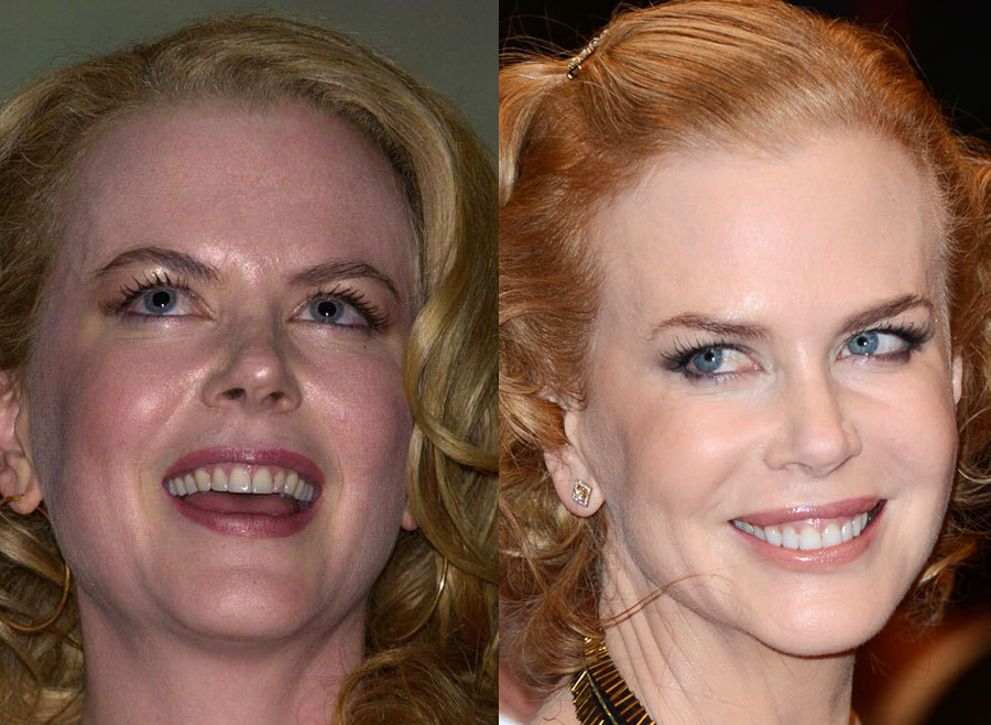 7.-Nicole-Kidman